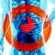 Xray image of man with pain radiating from stomach